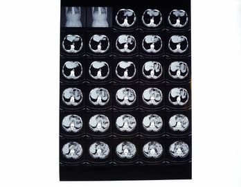 أفلام الأشعة السينية الطبية ، فيلم التصوير الجاف متوافق مع الطابعة الحرارية للأشعة المقطعية / DR / MRI